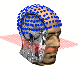 EEG MRI 3D reconstruction